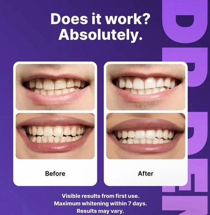 DR.DENT Purple Tooth Whitening Strips Peroxide Free 14 Treatments for Teeth
